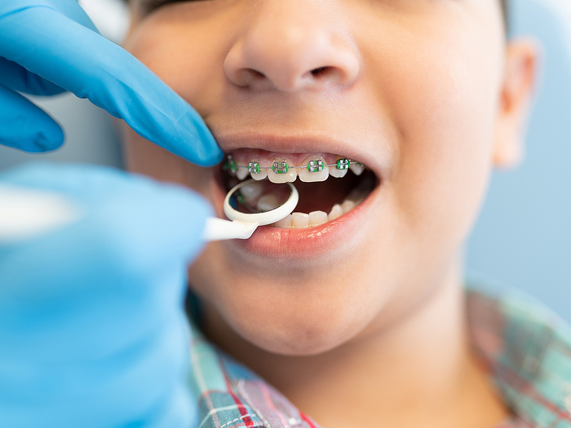Everything You Need to Know About Orthodontics